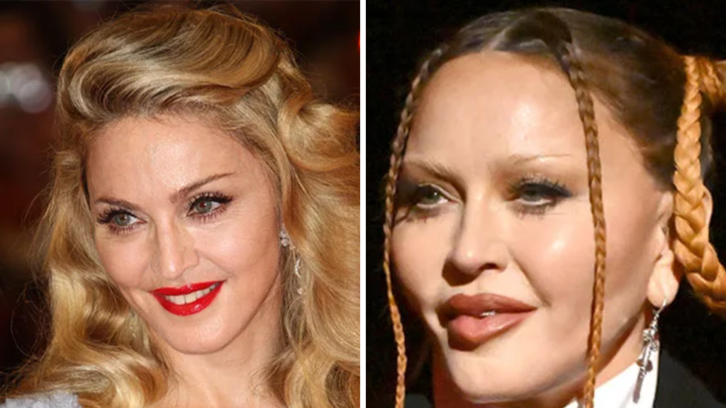 madonna-before-and-after