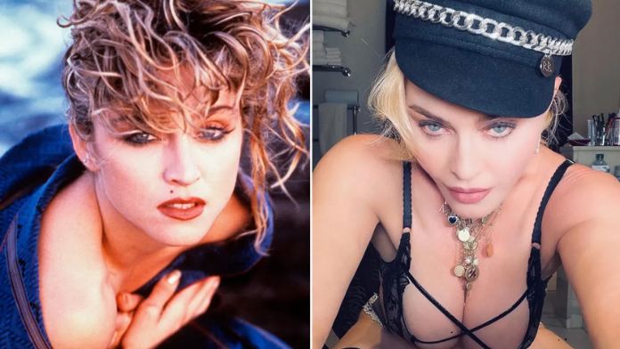 Madonna Before and After Plastic Surgery